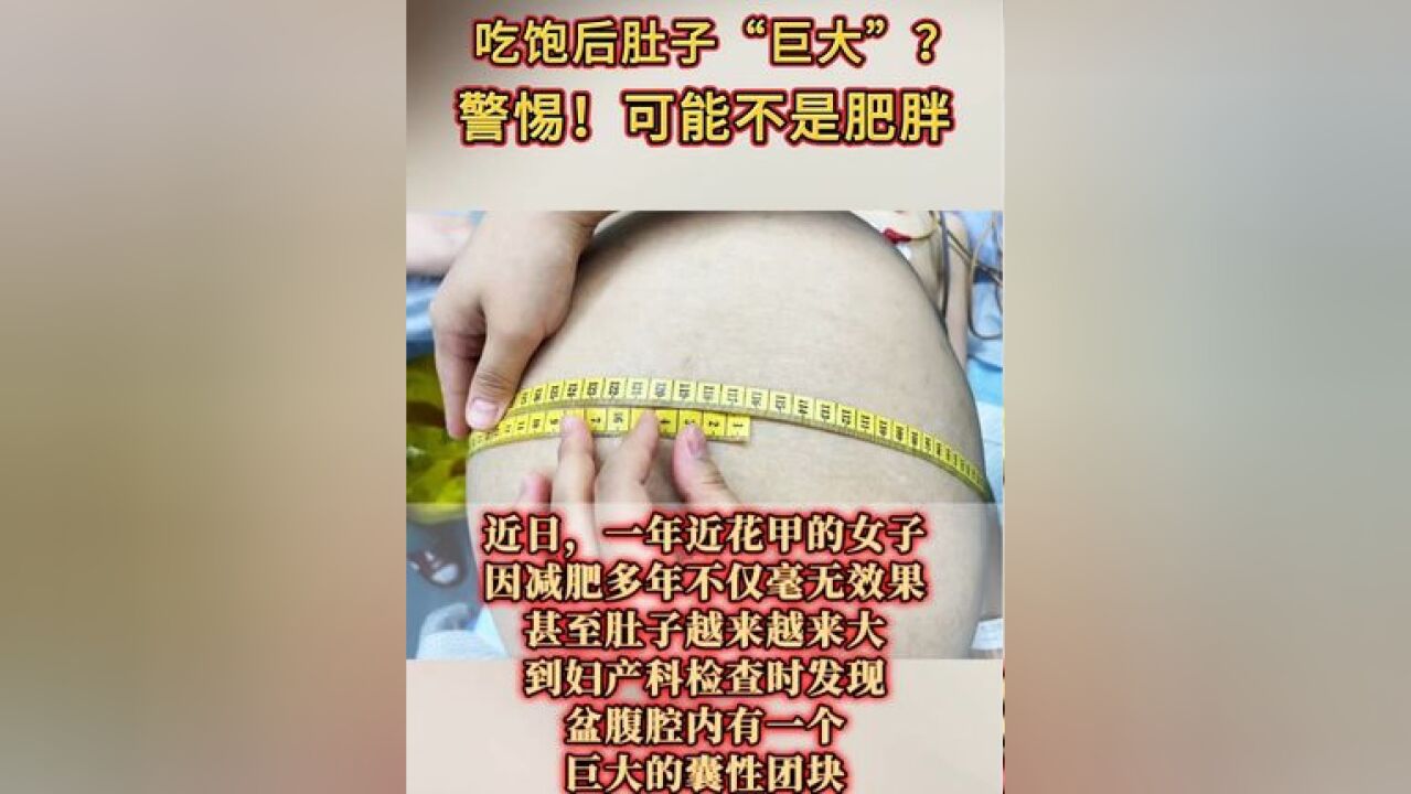 吃饱后肚子“巨大”?警惕!可能不是肥胖!