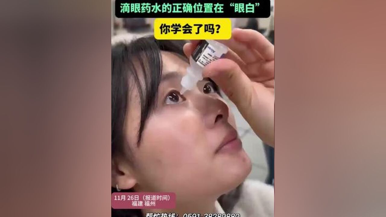 正确滴眼药水的“姿势”,滴眼药水的正确位置在“眼白”,你学会了吗?