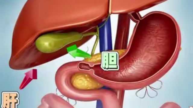 胆结石是怎么进入身体的?专家一张图为你解答,转给有需要的家人