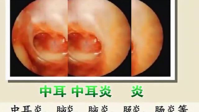 疾病预防动画课堂之麻疹,如果你的孩子有这些状况,注意啦