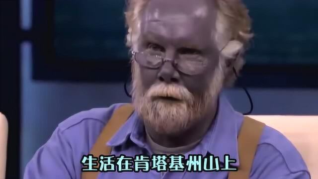 世界上还有蓝种人?全身皮肤是蓝色,既聪明行动又敏捷,世界罕见