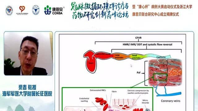 冠脉微循环障碍诊疗最新进展