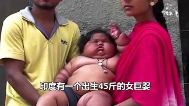 女巨婴重达45斤,如今6岁了,视频记录成长全过程!