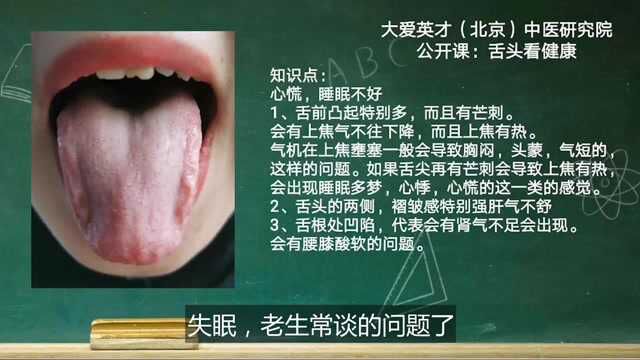 舌象分析:心慌,失眠,睡眠多梦,腰膝酸软的舌象讲解