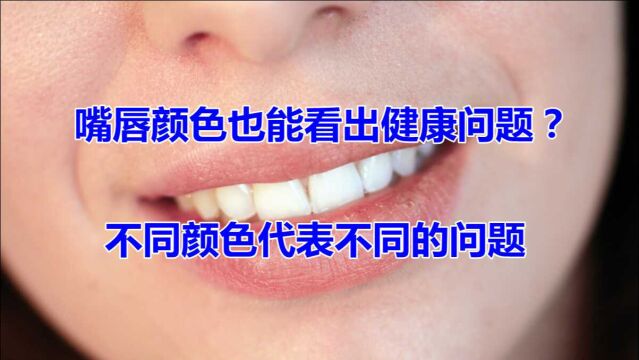 嘴唇颜色也能看出健康问题?不同颜色代表不同的问题