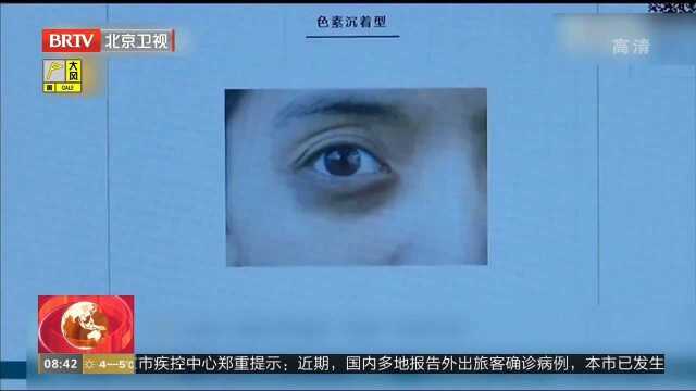 你有“熊猫眼”吗?南京一医院开设黑眼圈门诊