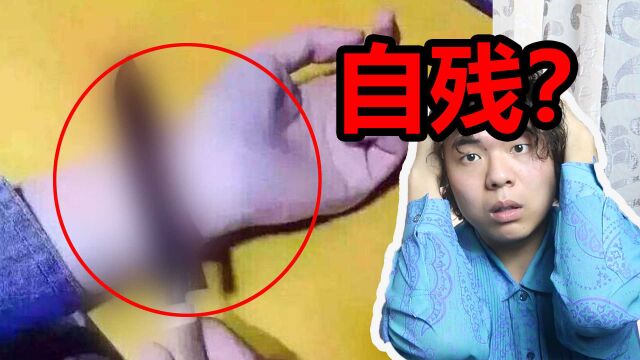 如何走出自残 人为什么会选择自残?