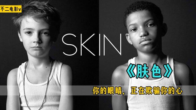 奥斯卡获奖最佳短片《肤色Skin》:你的眼睛,正在欺骗你的心