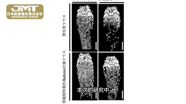 日本干细胞——自噬激活成骨细胞的机制,有望应用于骨质疏松药物