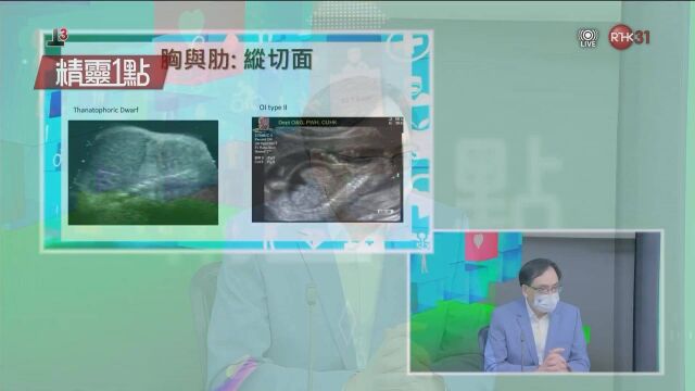 香港电视:RTHK31 最新有效高清直播源 2022年8月10日