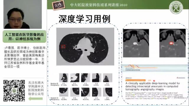 人工智能在医学影像的应用:以神经系统为例中大卢春强