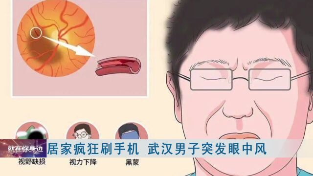 小伙突然左眼看不见!只因与这个习惯有关,医生提醒