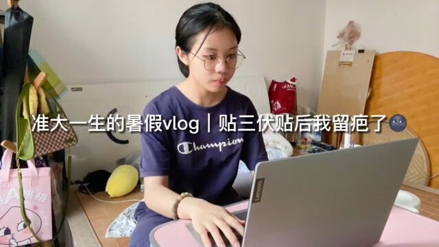 准大一生的暑假vlog贴三伏贴居然过敏了 晕4!之前在青岛贴的三伏贴我以为只是过敏鬼知道会留疤呜呜呜呜呜呜,有没有有类似经验的集美!求告知