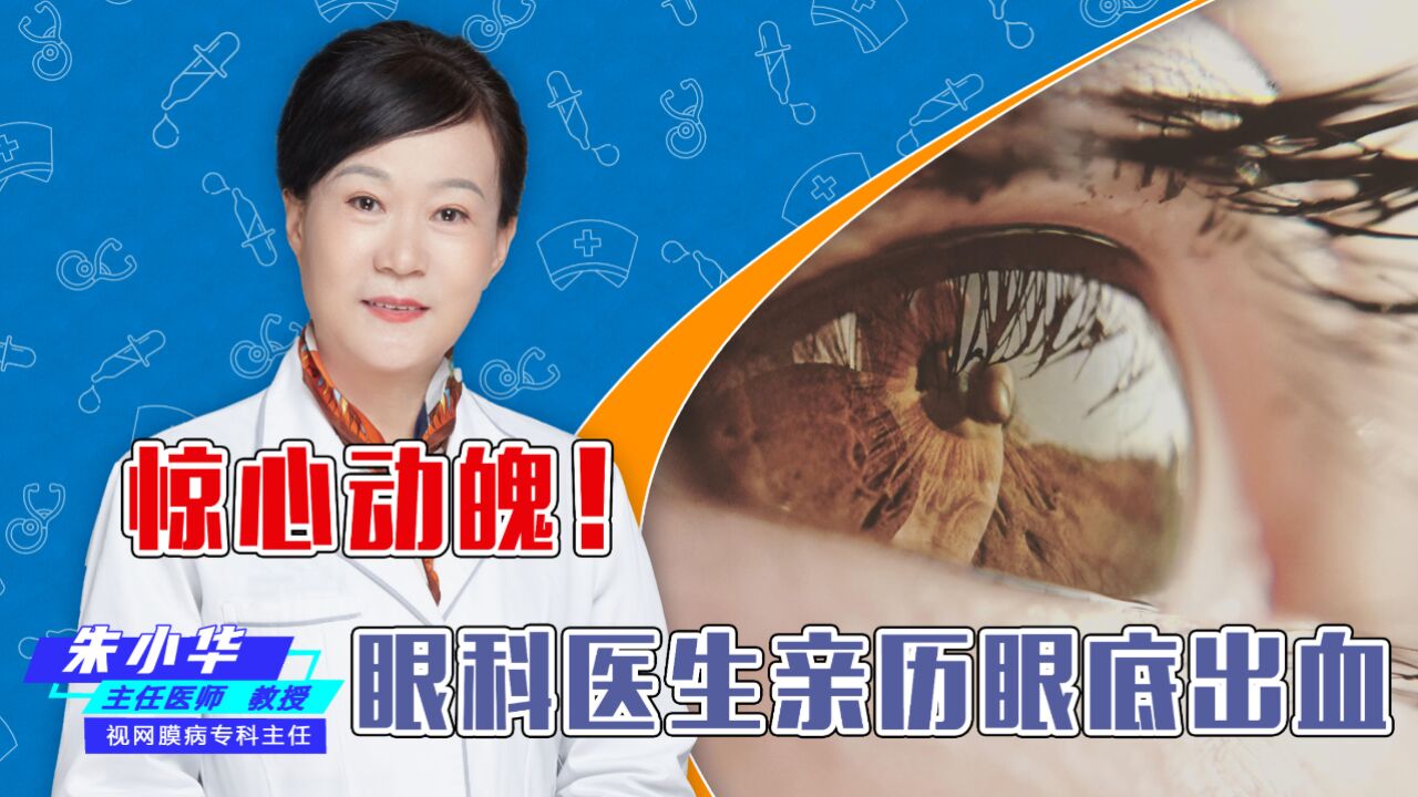 惊心动魄!眼科医生亲历眼底出血