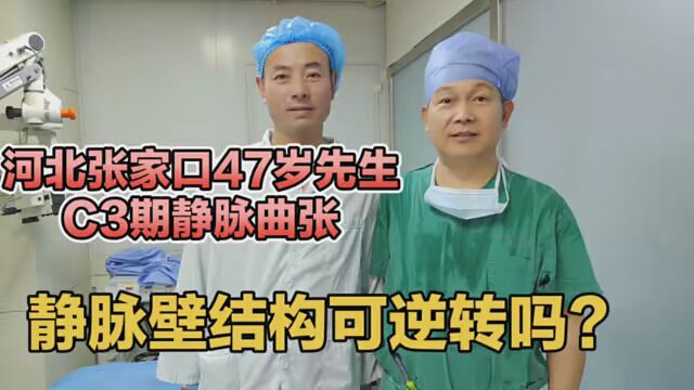 张家口47岁患者静脉曲张10年,静脉壁结构如何?静脉曲张会逆转吗 #开学的精神状态