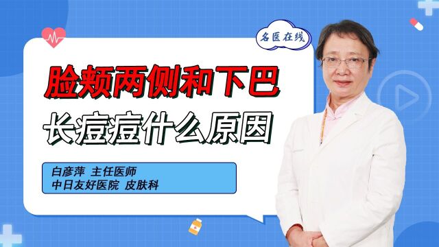 肌肤问题?痘痘频出?全面解析脸颊两侧和下巴的痘痘原因!