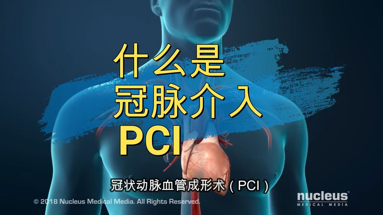 什么是冠脉支架 s3519vvrg4c_hz.jpg