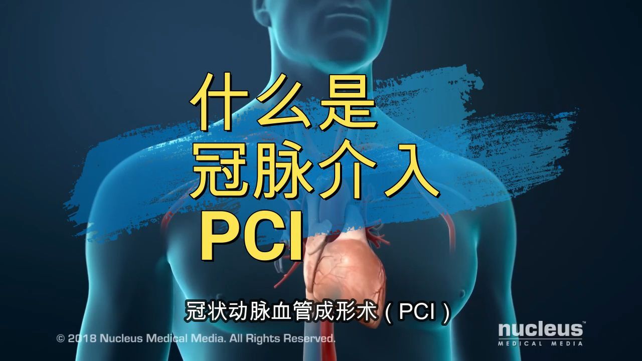 什么是冠脉介入PCI,心脏支架有什么用