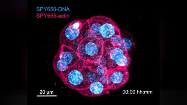 《细胞》:科学家终于看清了人类胚胎早期发育!发现DNA致命错误竟另有原因(附视频)