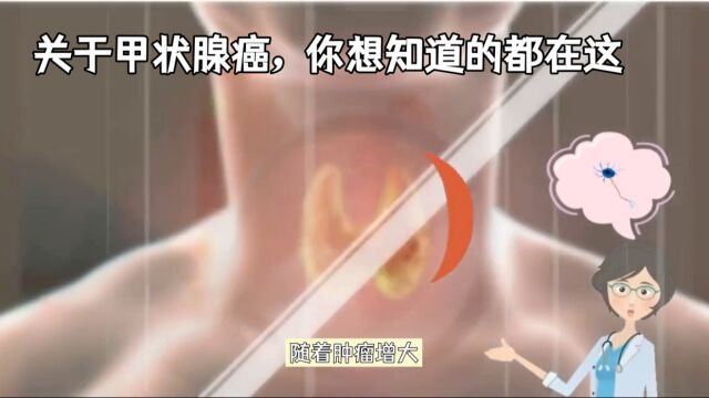 关于甲状腺癌,你想知道的都在这