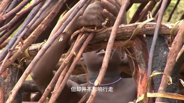 这里的人仅有2根脚趾头,却不影响行走,被人称为“鸵鸟人”