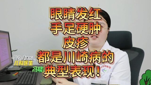 眼睛发红、手足硬肿、皮疹,都是川崎病的典型表现!