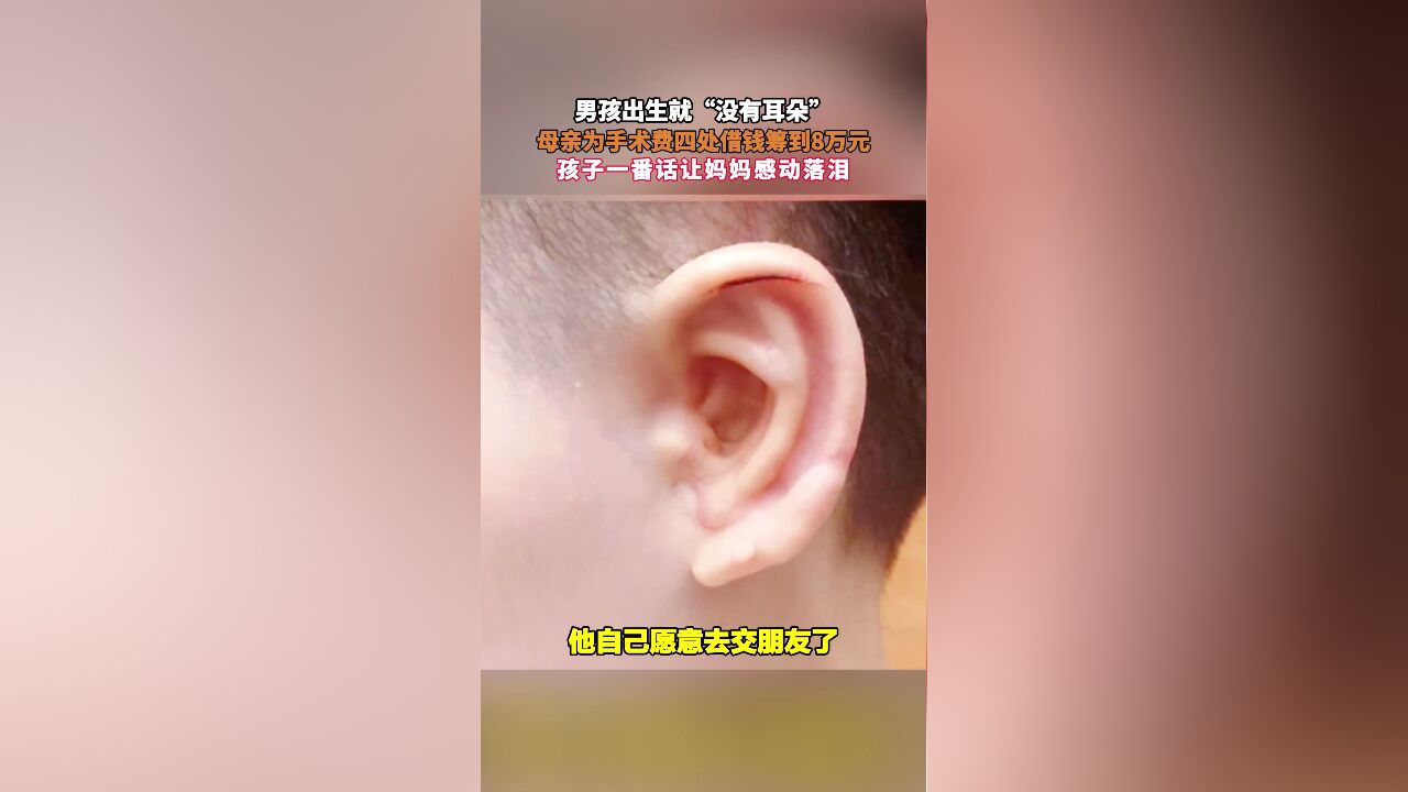 男孩出生就“没有耳朵”,母亲为手术费四处借钱筹到8万元,孩子一番话让妈妈感动落泪