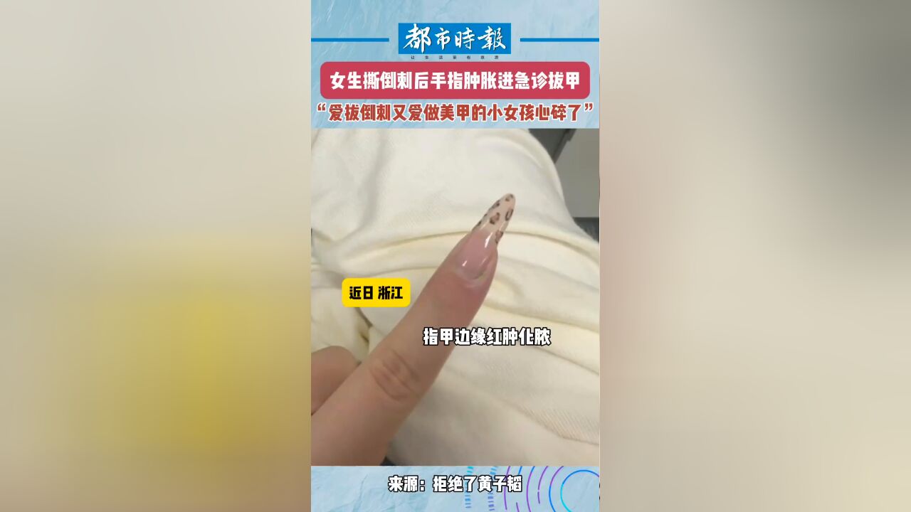 女生撕倒刺后手指感染拔甲治疗