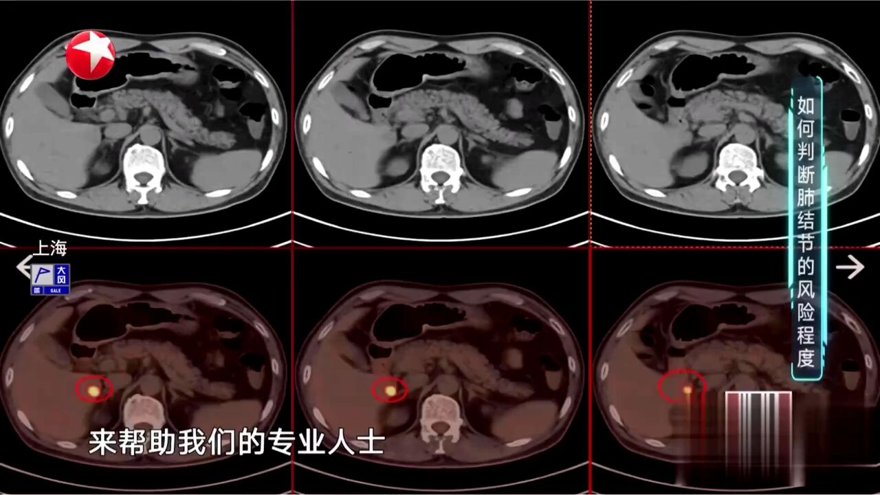 名医教你如何养生