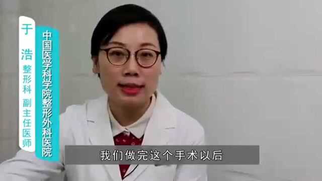 埋线双眼皮术后多久可以消肿