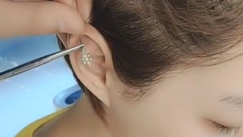 没错！扎耳尖就是这么简单，一点都不疼，快准狠！ - 腾讯视频