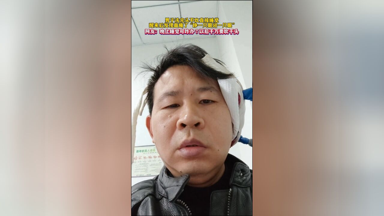 男子洗完头不吹直接睡觉,醒来后发现面瘫了 “睁一只眼闭一只眼”,网友:晚上睡觉可咋办