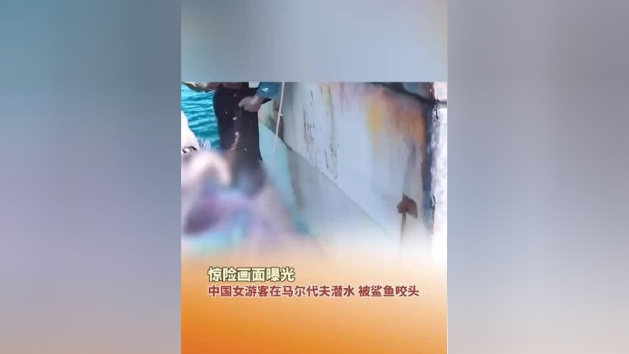 近日,一名中国女游客在马尔代夫潜水 ,被鲨鱼咬头,挣扎逃离,伤口被缝40多针