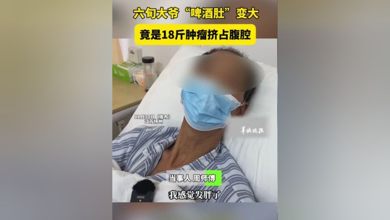 六旬大爷“啤酒肚”变大 竟是18斤肿瘤挤占腹腔