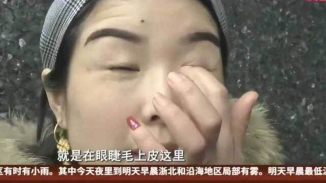 女子追求潮流,给眼球上“纹身”,结果麻药伤到眼睛