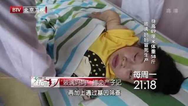 生命缘:玻璃妈妈1:孕妇身高89厘米体重58斤,患有罕见病症!