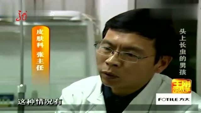 王刚:医生排除男孩患病可能,判断其头上长虫可能是人为的!