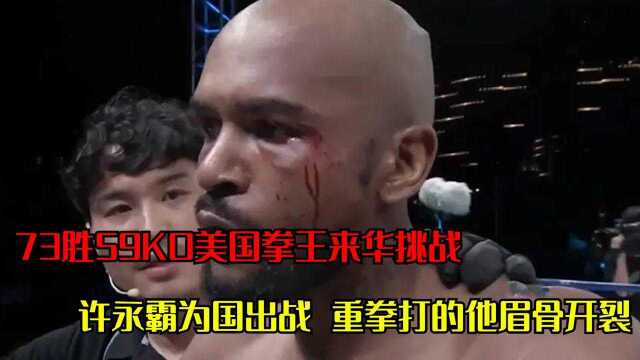 73胜59KO美国拳王来华挑战,许永霸为国出战,重拳打的他眉骨开裂