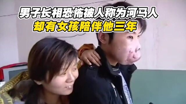 男子长相恐怖被人称为河马人,却有女孩陪伴他三年,你羡慕了吗?