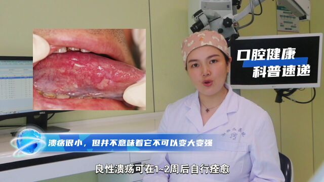 口腔白斑变口腔癌,湘雅二医院谢小燕提醒:这些癌前病损要重视