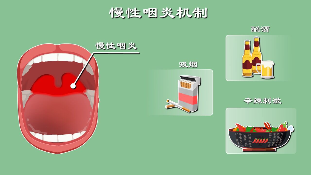 喉咙发痒咋回事?还恶心、干呕?生活中这件事竟能搞出慢性咽炎