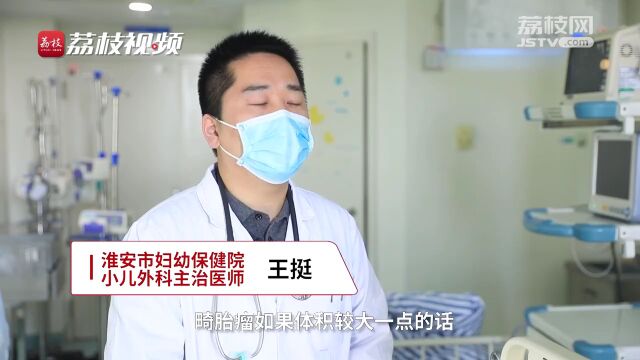 心疼!淮安一新生男婴长了个“松鼠尾巴” !