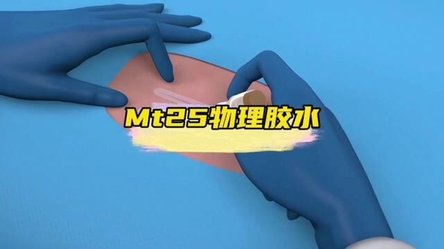 这是黑科技伤口闭合的奇迹MT25生物胶水. #生物胶水 #免疫系统 #皮肤健康 #黑科技 #国外视频分享