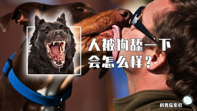 人被狗舔了一下,会发生什么可怕的事情?会得狂犬病丢掉性命吗?