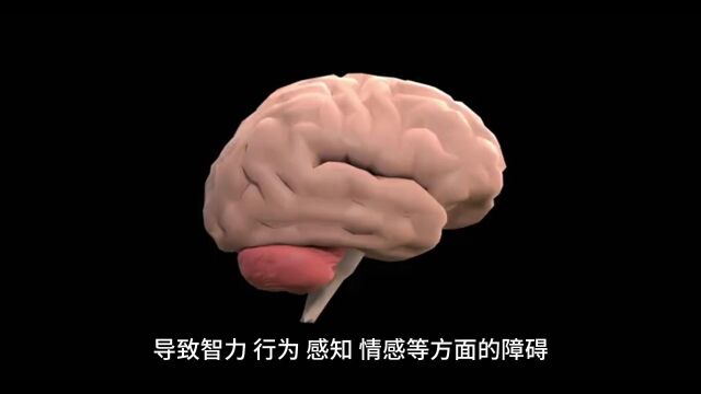 南昌二七医院:孩子脑发育不良应该如何应对