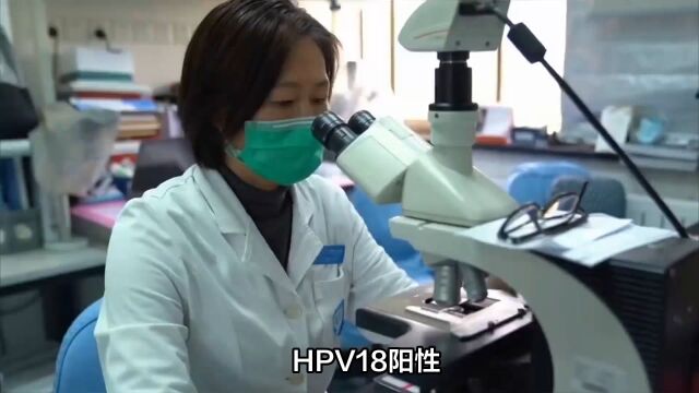 单纯hpv18阳性需不需要治疗?南京家和医院