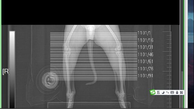 DICOM图像浏览器教程