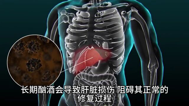 脂肪肝怎么调理最好最快,最后一种方法简单又实用