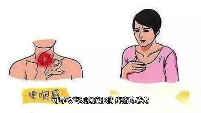 肝气郁结会出现什么表现?