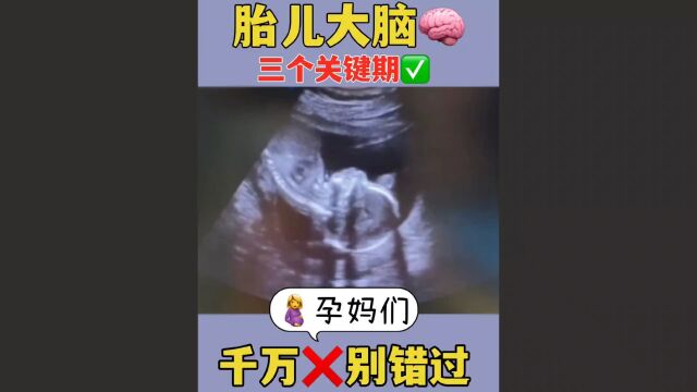 胎儿大脑,三个关键期,孕妈们千万别错过